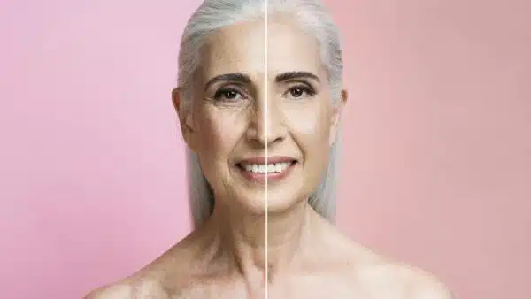 Adeus rugas! Este botox natural à base de cravo se tornará seu grande aliado